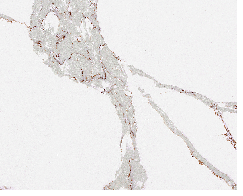 The 3 Most Stunning Calacatta Quartz Ideas 4 Stone Surfaces PMC2282
